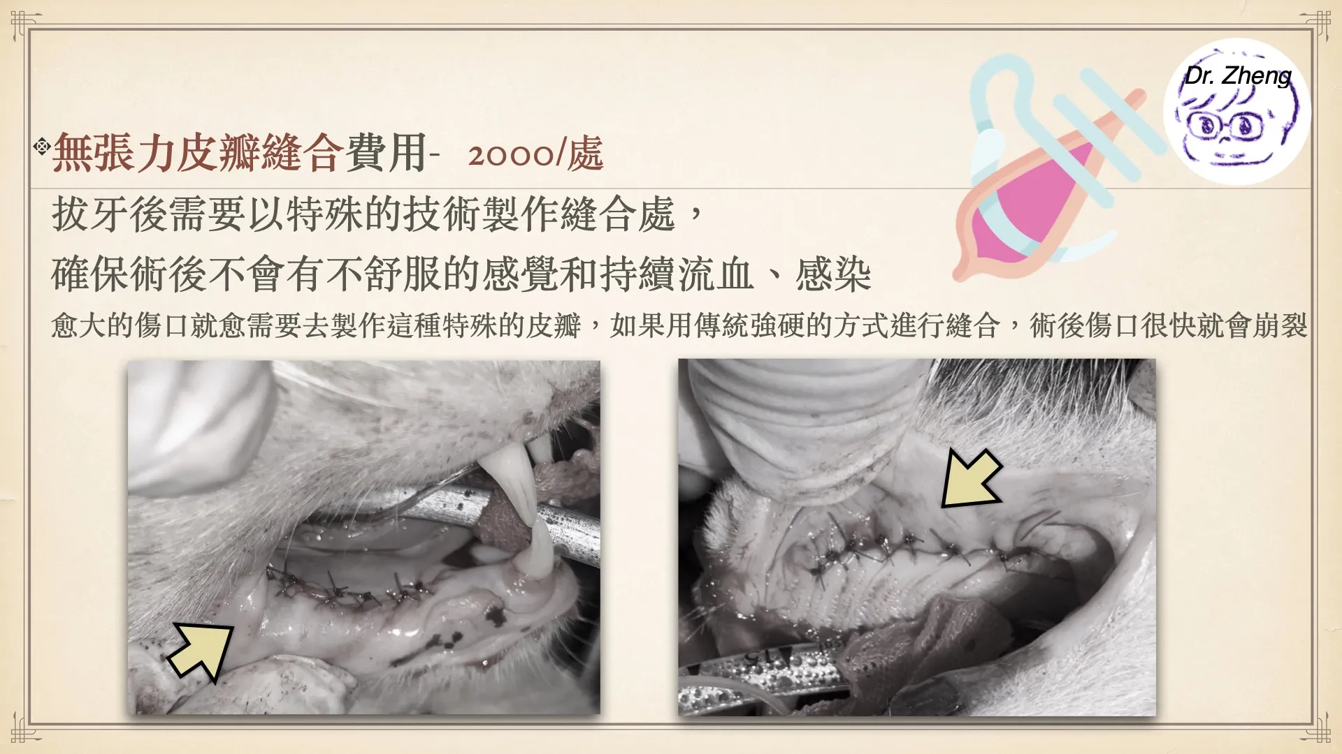 犬貓拔牙手術後進行無張力皮瓣縫合的示意照片,避免術後傷口感染與裂開。