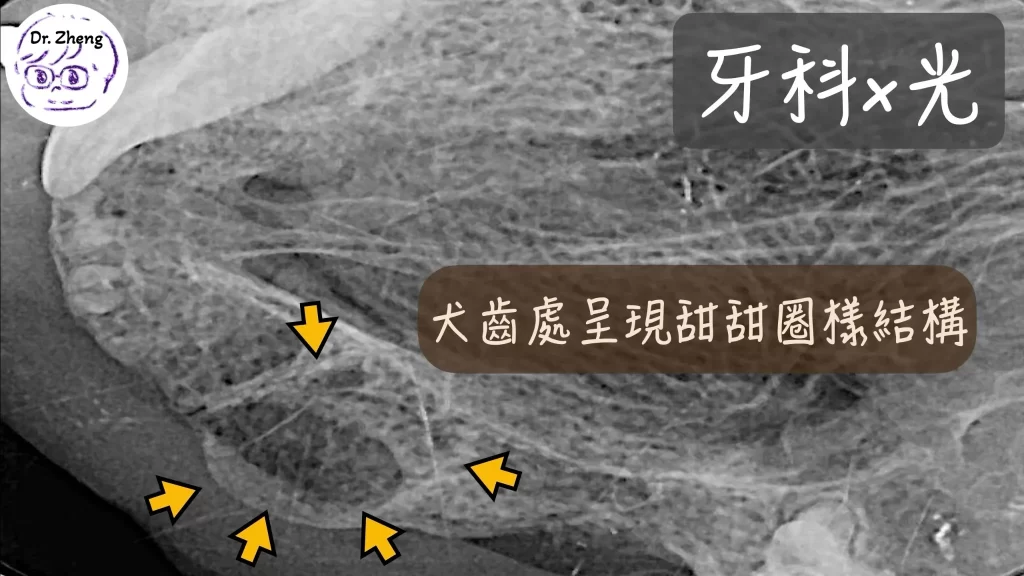 貓咪牙科X光，顯示犬齒區域有甜甜圈樣結構