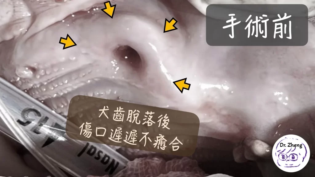 貓咪嘴巴有洞！貓咪上顎犬齒脫落後傷口未癒合