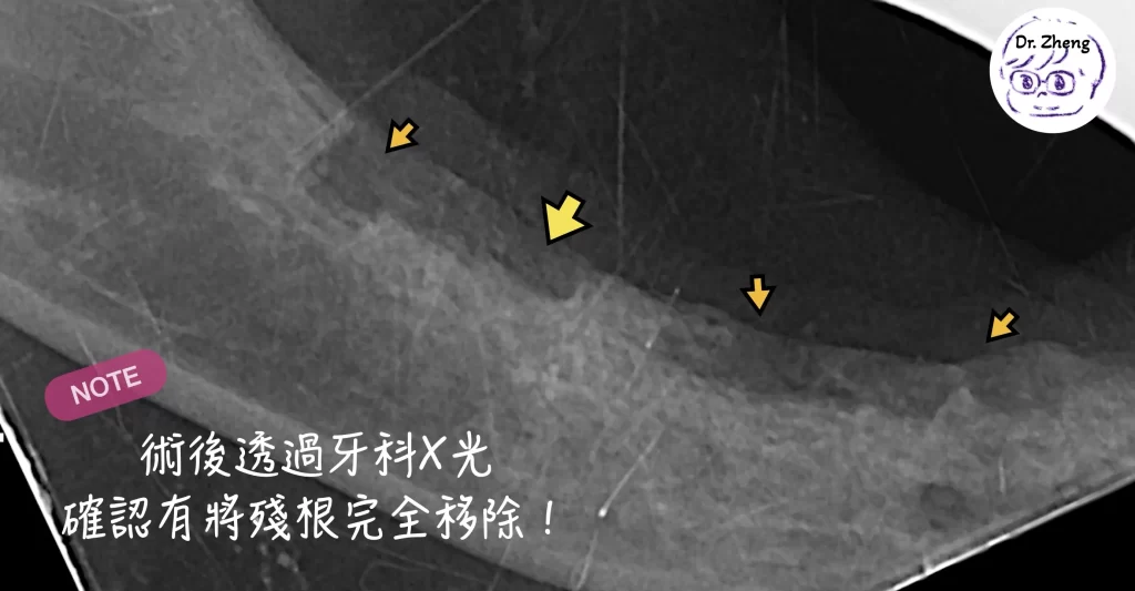 貓咪拔牙術後X光確認殘根清除乾淨