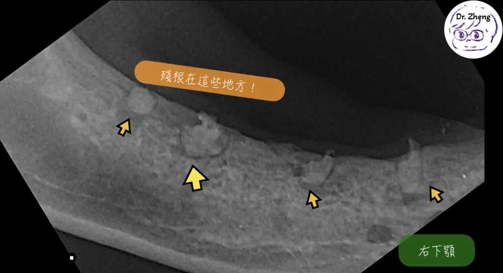 牙科X光顯示貓咪下顎殘根位置