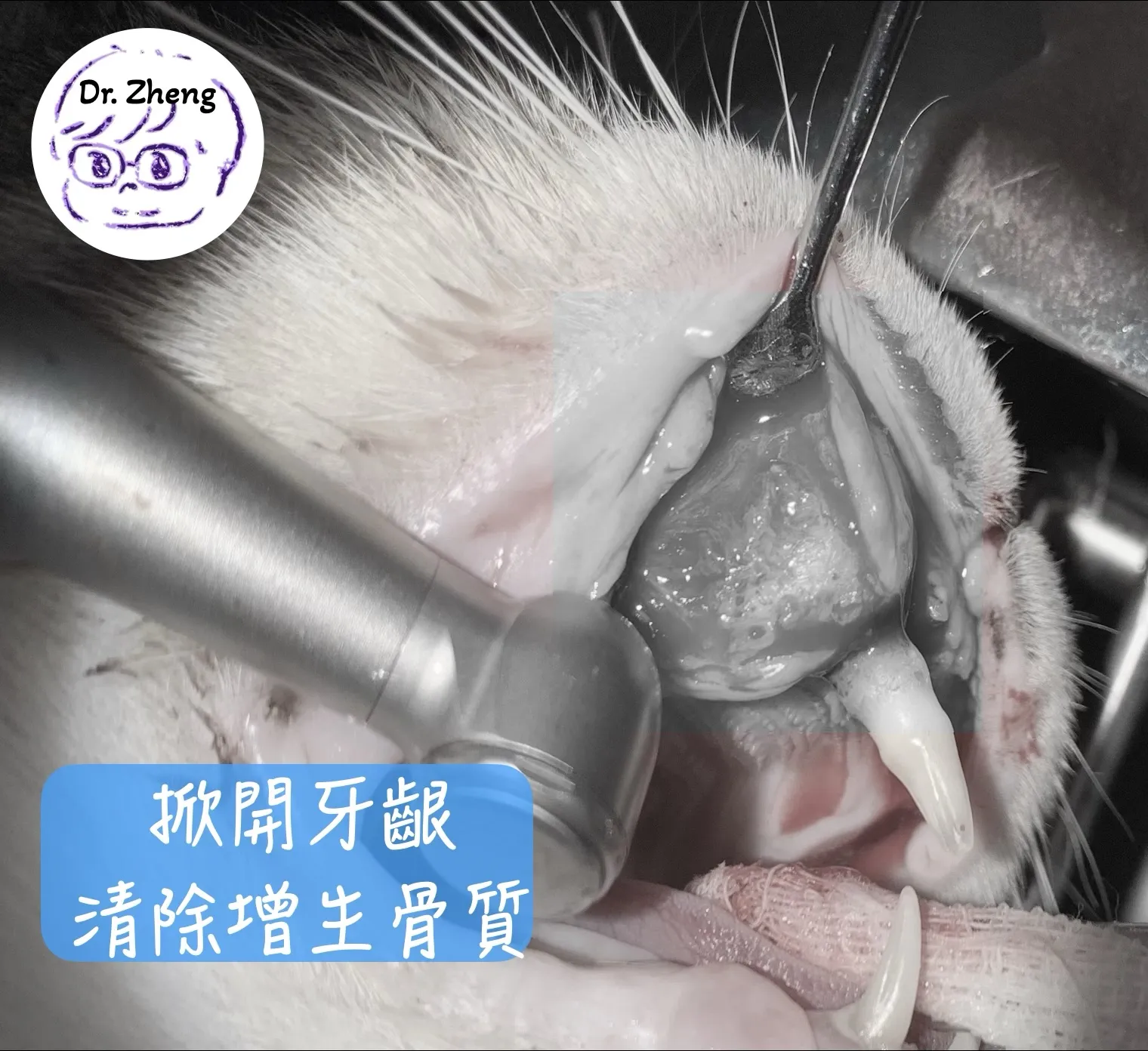將牙齦掀開後，清創底部
