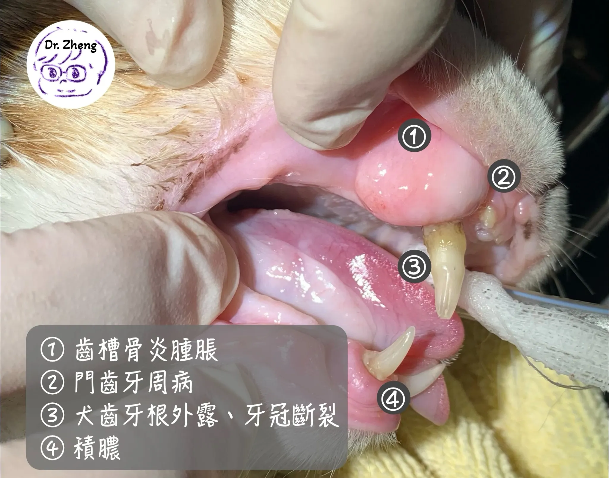 貓咪麻醉後進行完整牙科COHAT，發現犬齒有嚴重的慢性骨髓炎