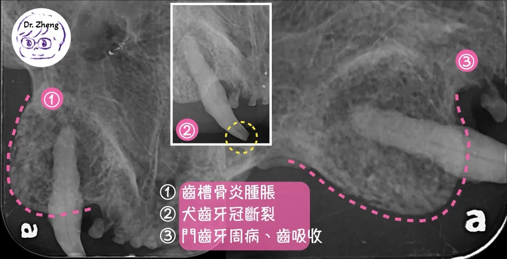 透過牙科X光，我們得以釐清病因