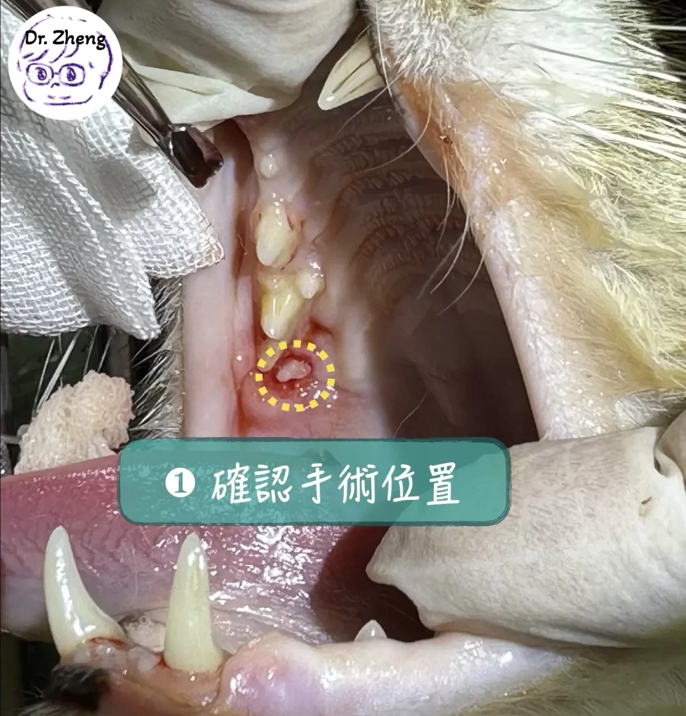 手術前先確認上顎臼齒的位置