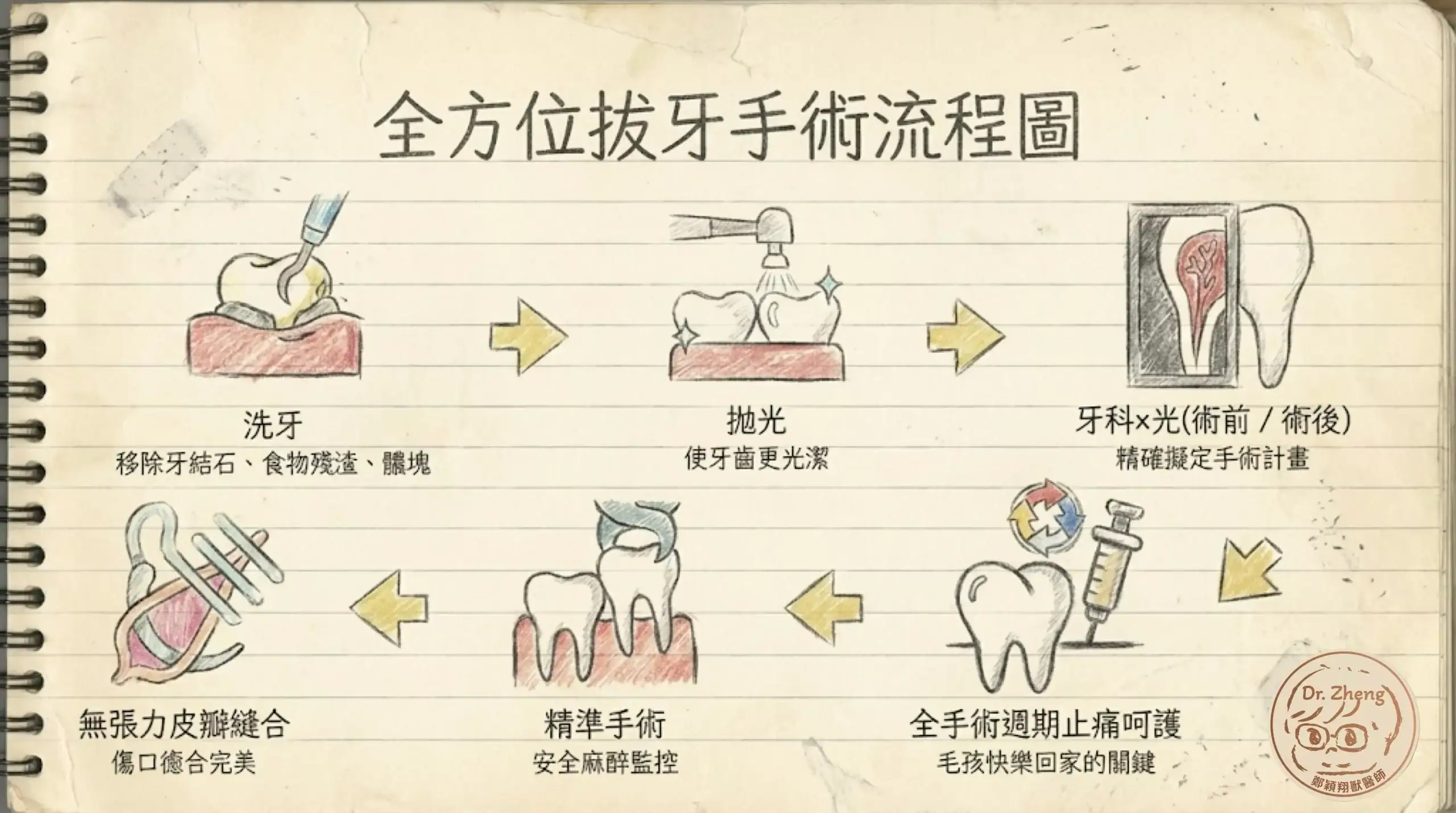 全方位拔牙手術流程圖