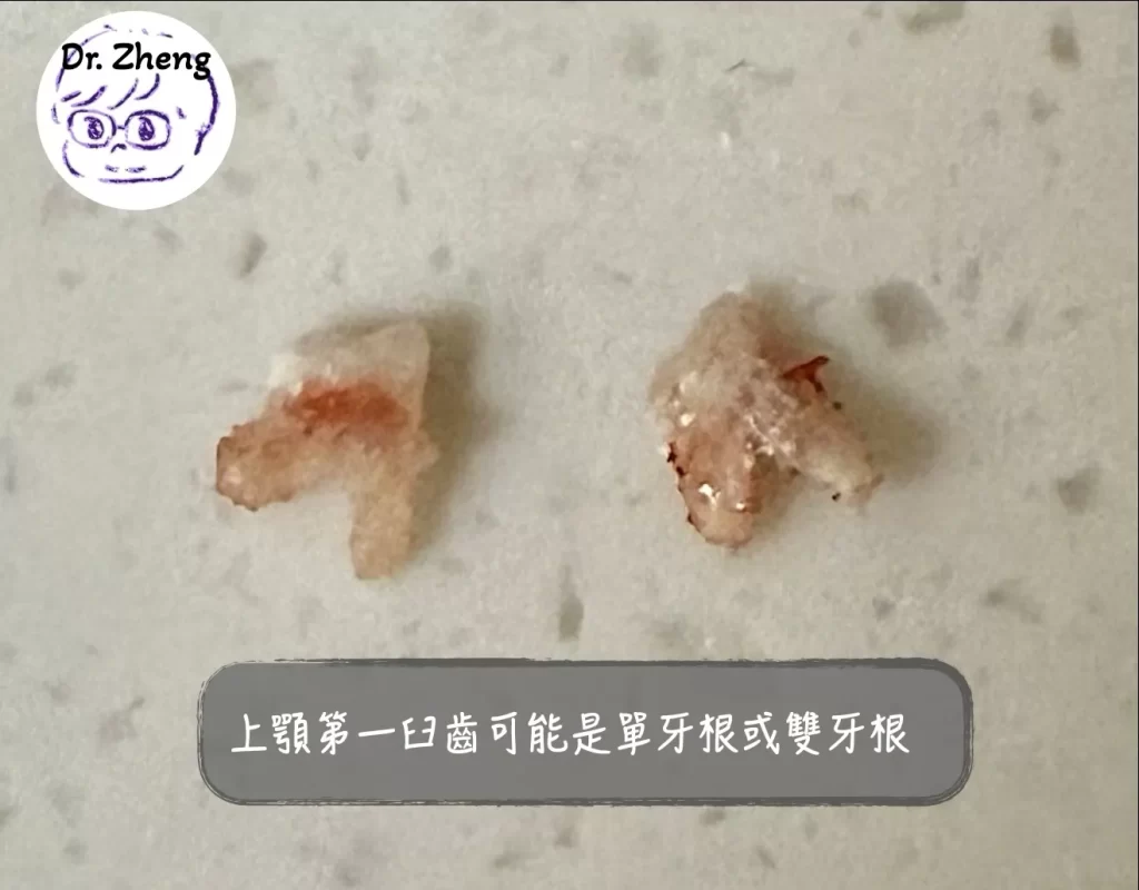 貓上顎最後一顆臼齒可能是單牙根或是雙牙根牙齒