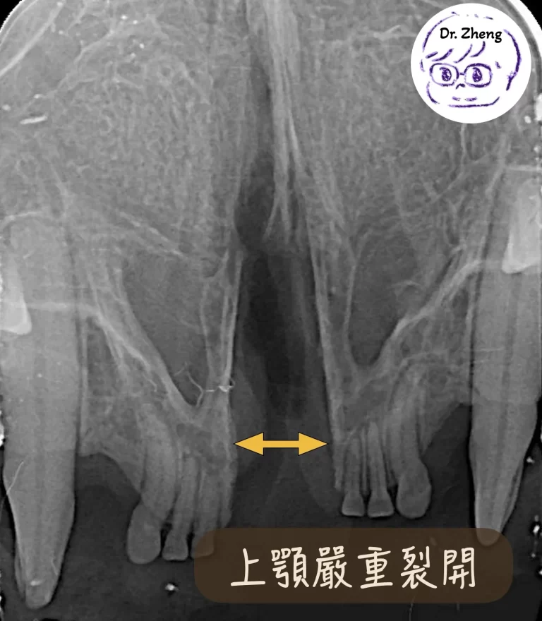 貓咪上顎裂 X 光顯示顎骨嚴重分離的影像