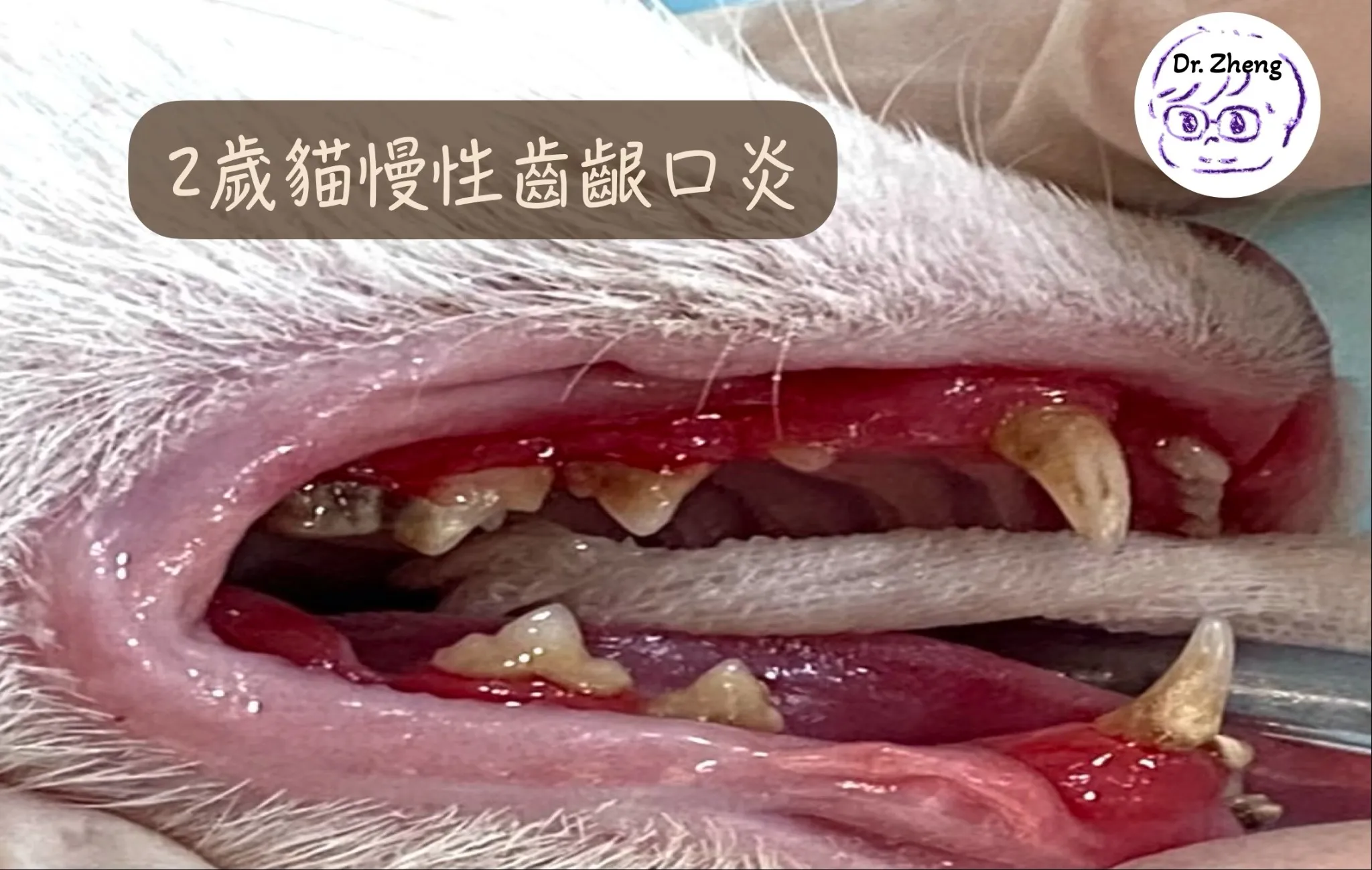 2歲貓咪因慢性齒齦口炎導致重度發炎與牙周組織破壞