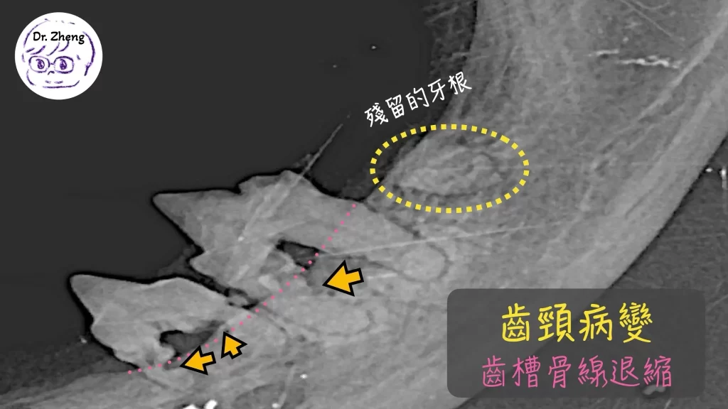 貓咪牙科X光顯示嚴重牙周病,有齒槽骨流失、齒吸收病變與殘留牙根