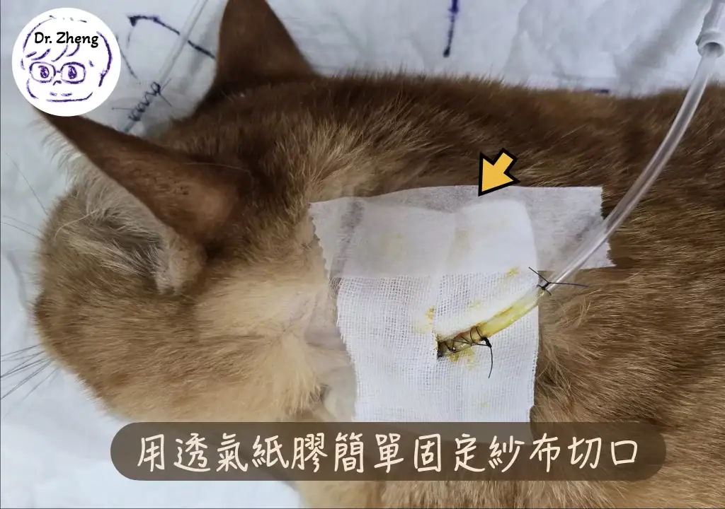 食道餵管換包紮：用透氣紙膠簡單固定紗布