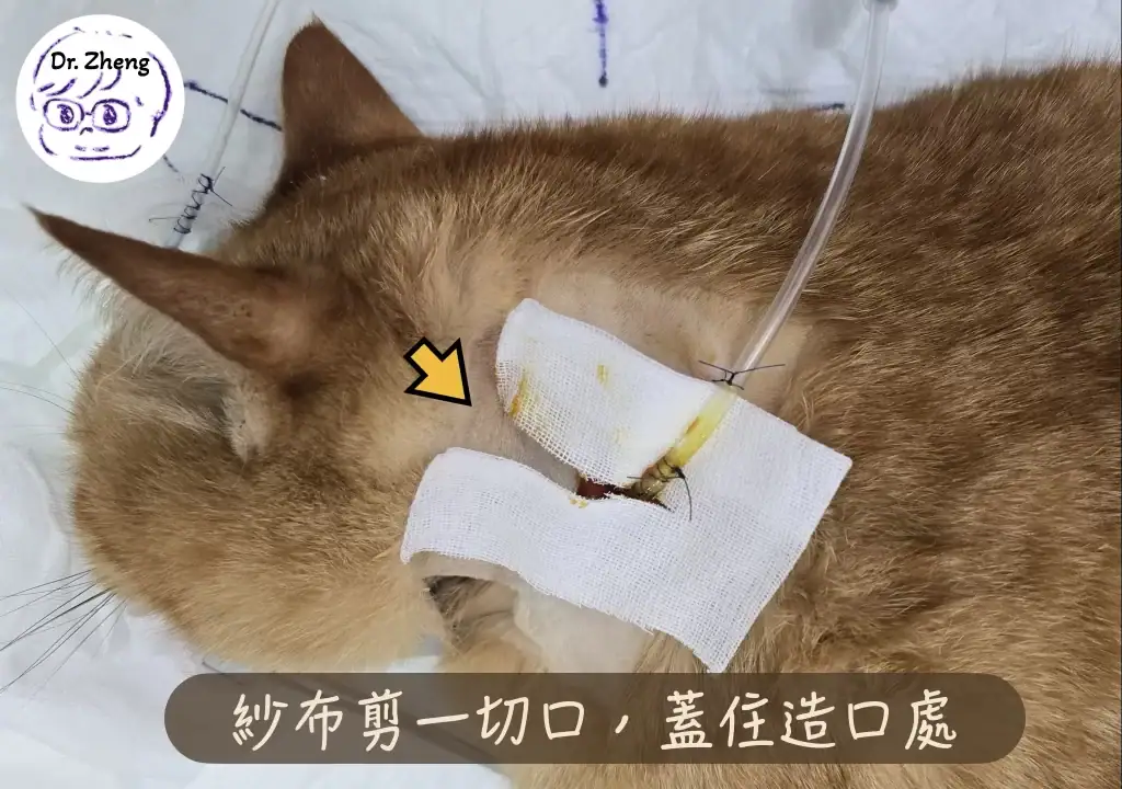 食道餵管換包紮：紗布剪一切口，蓋住照口處