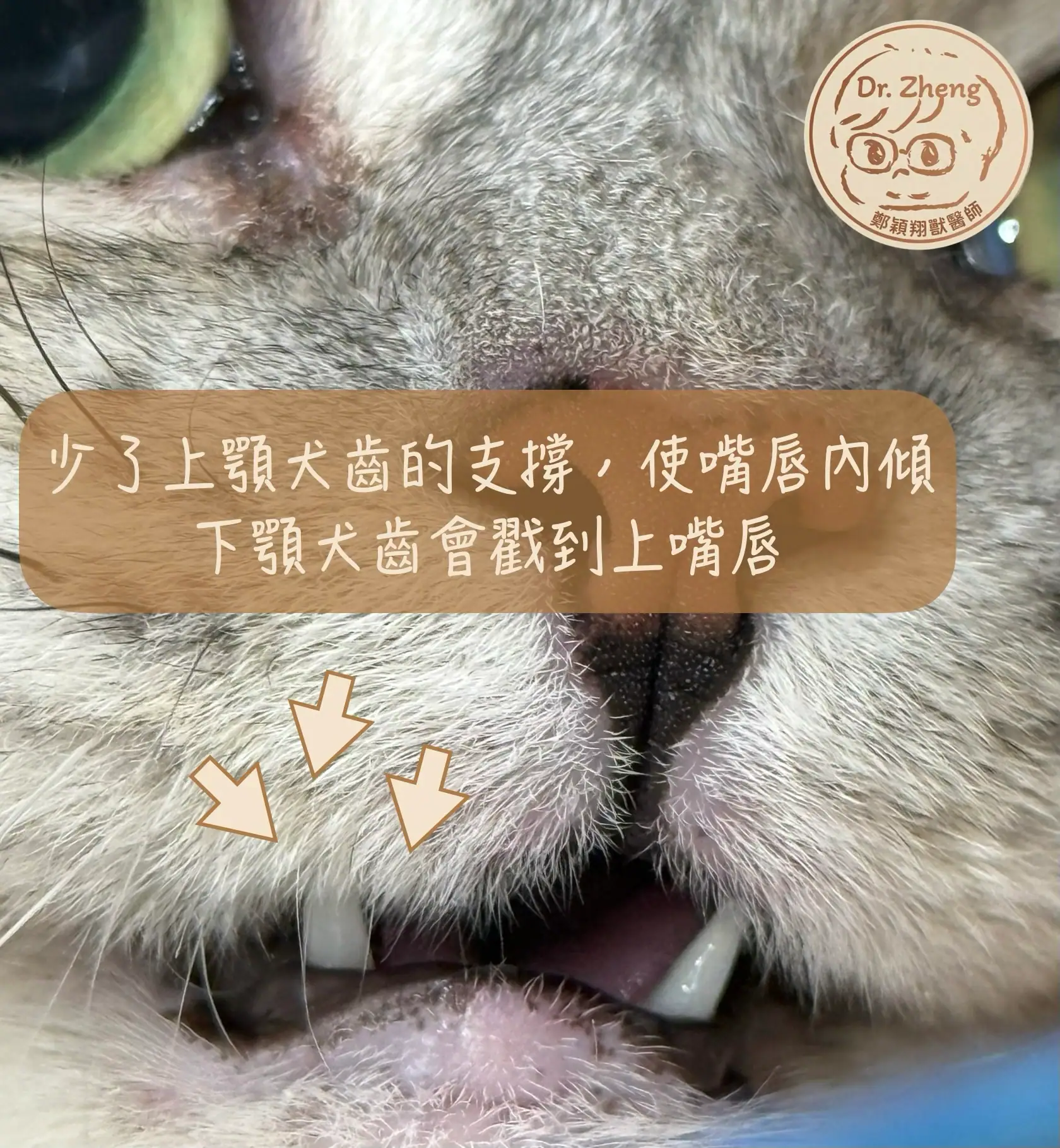 貓的上顎嘴唇閉圈通常是因為少了上犬齒的支撐.(貓拔牙後上唇夾傷)